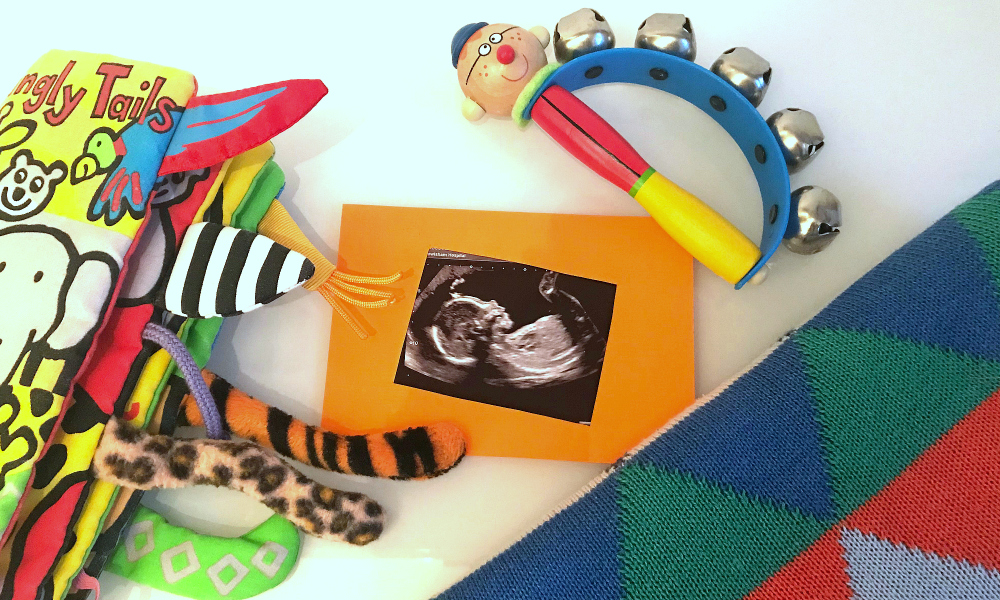 Pregnancy scan picture surrounded by toys